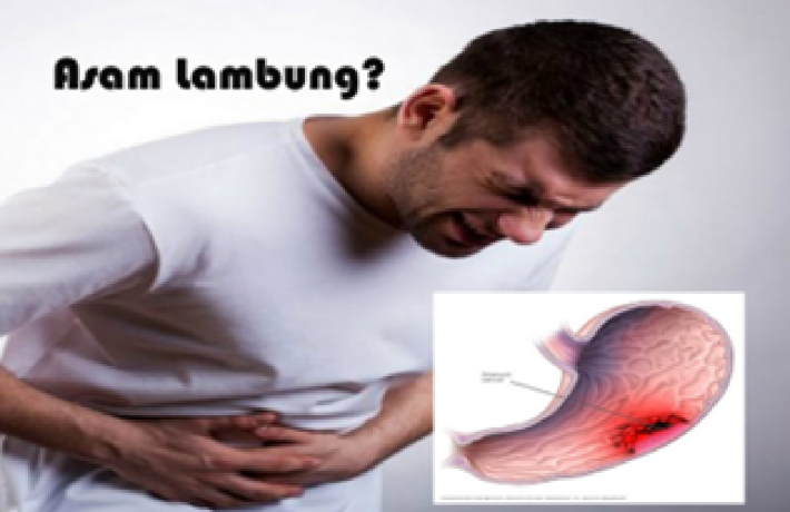 Pengumuman RSMH